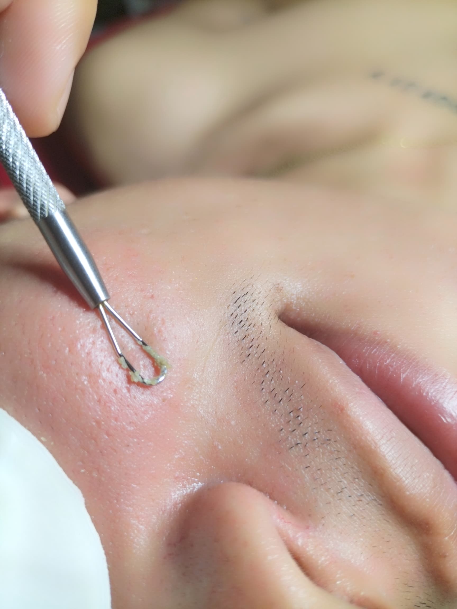 TRATAMIENTOS FACIALES 🧒