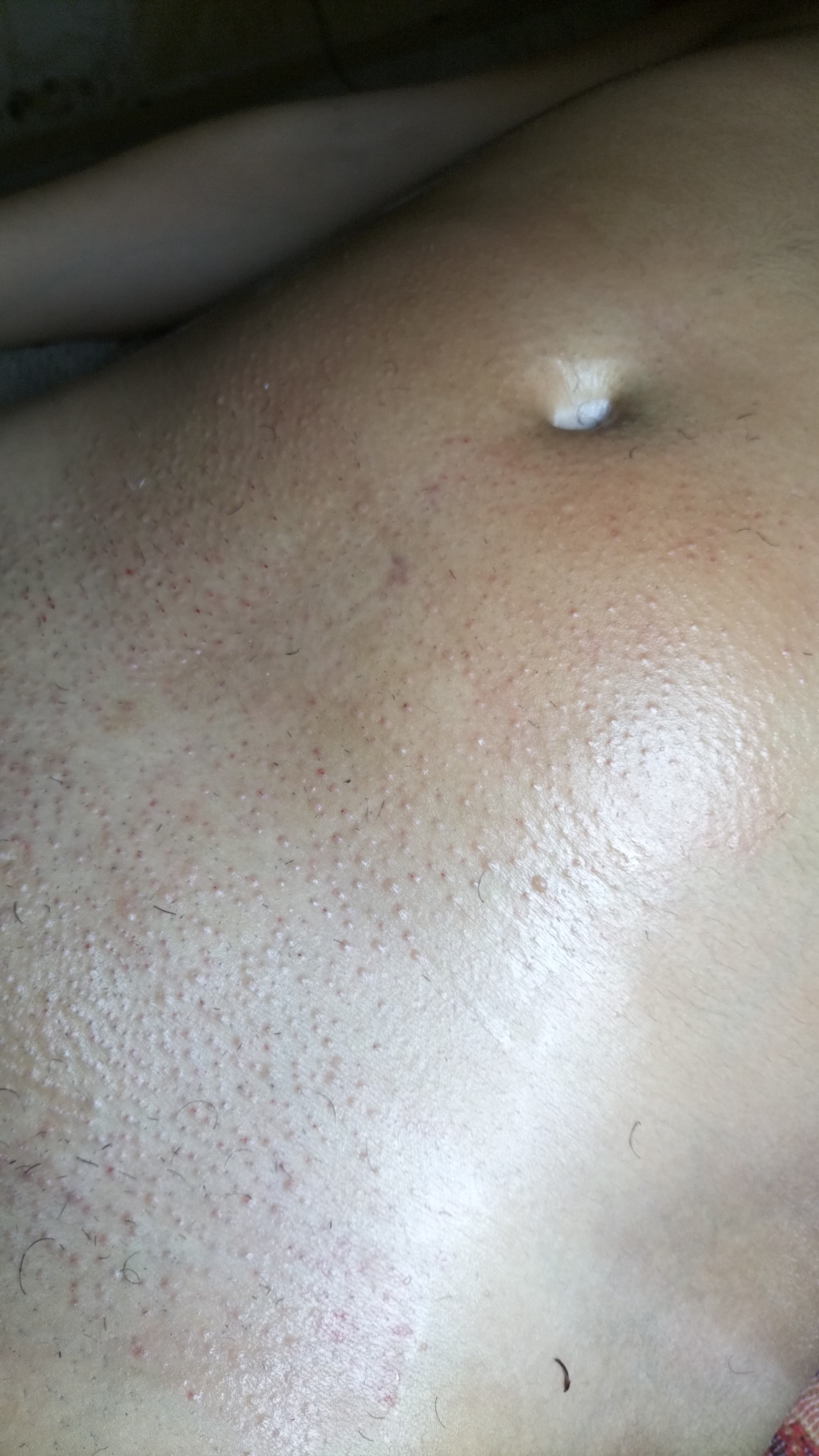 BIKINI NORMAL (BORDES)