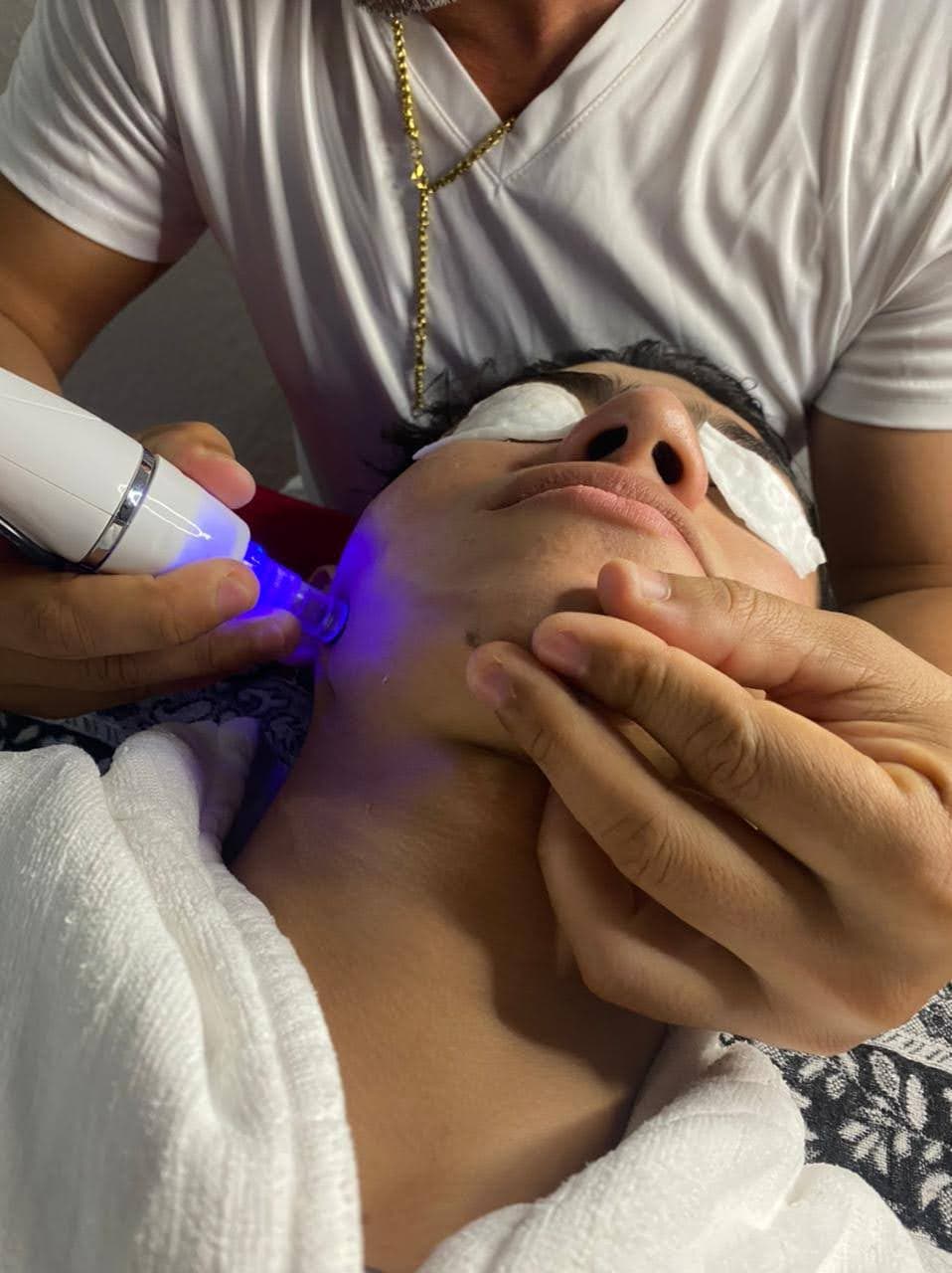 LIMPIEZA FACIAL PROFUNDA CON MICRODERMOABRASIÓN  - 3